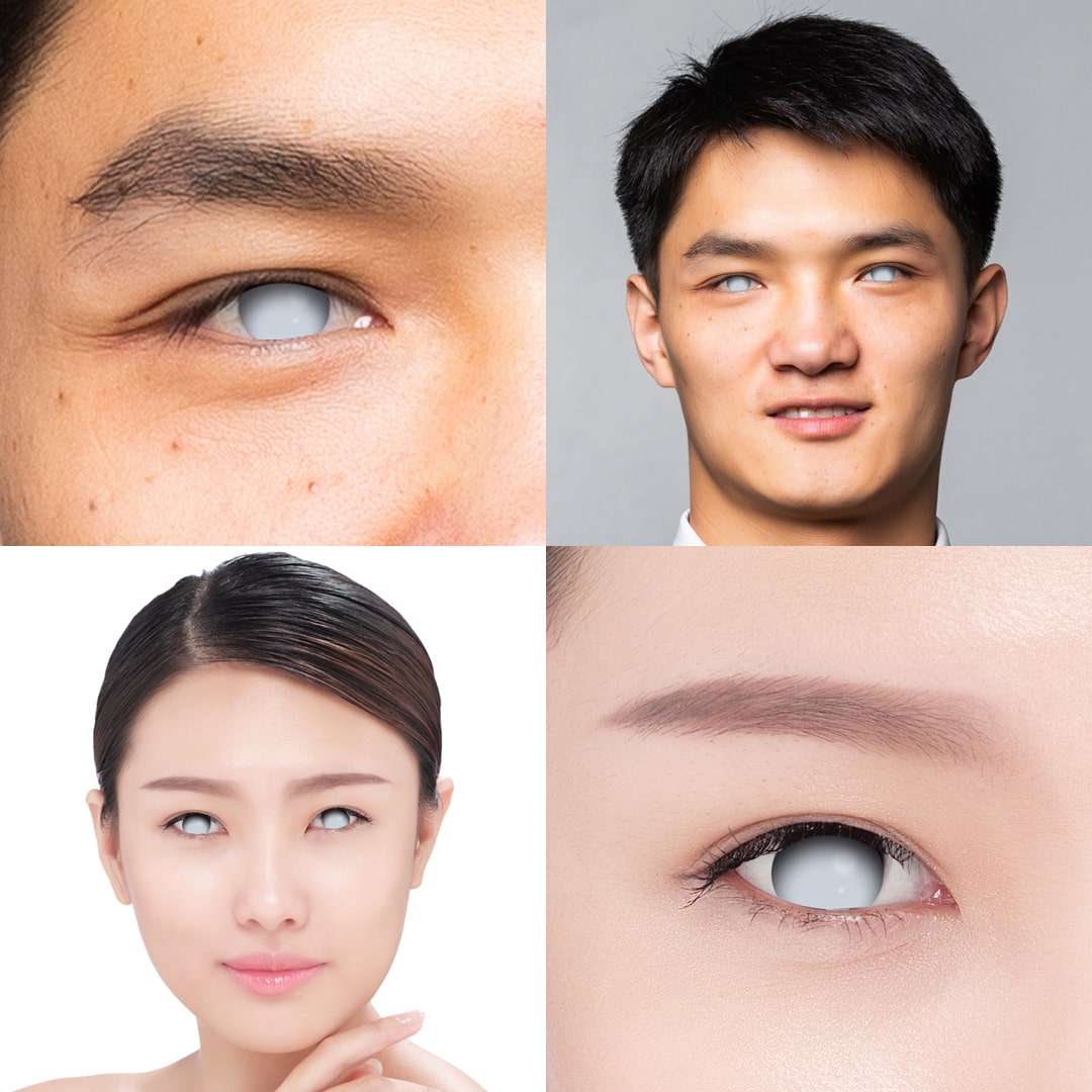 Blind White Contacts