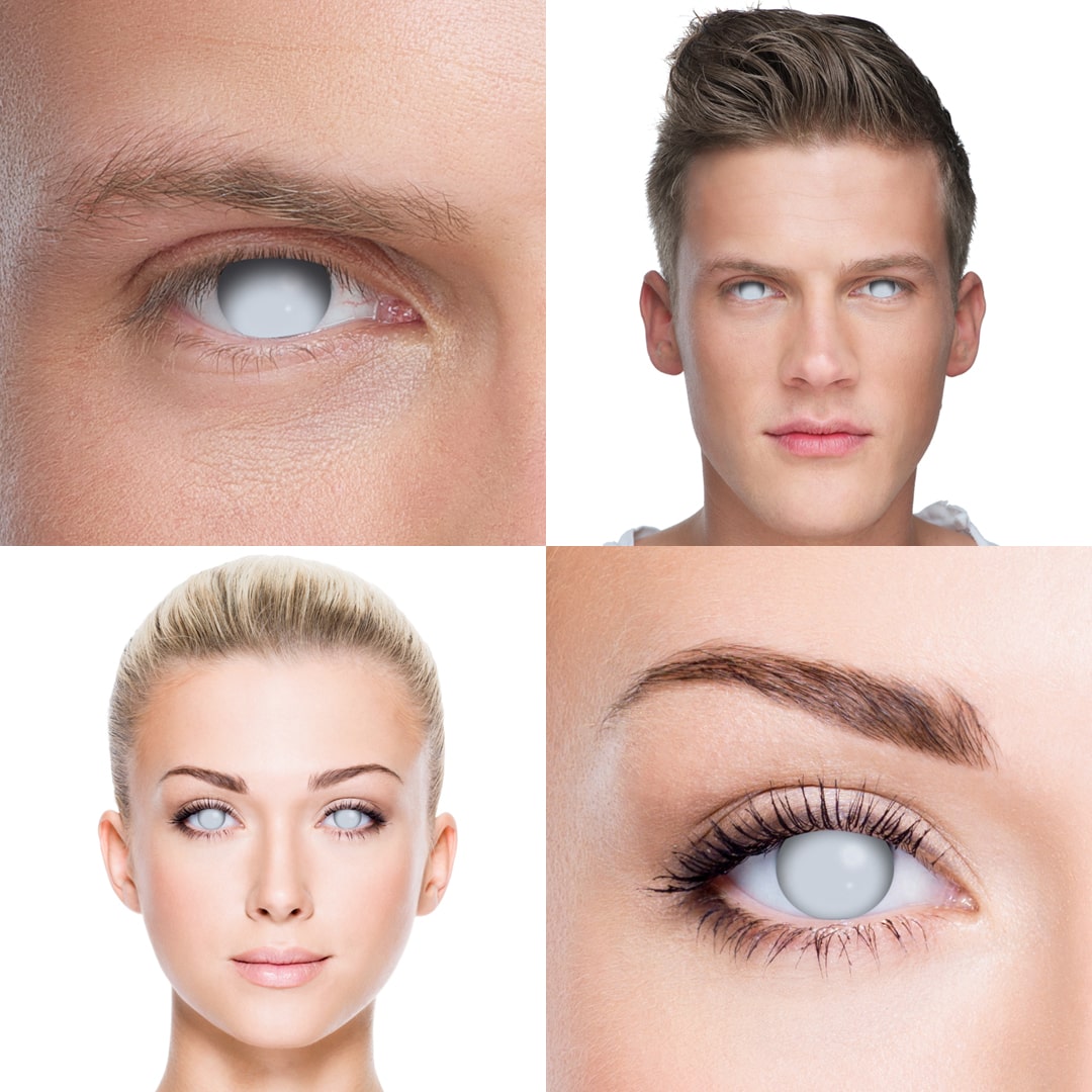 Blind White Contacts
